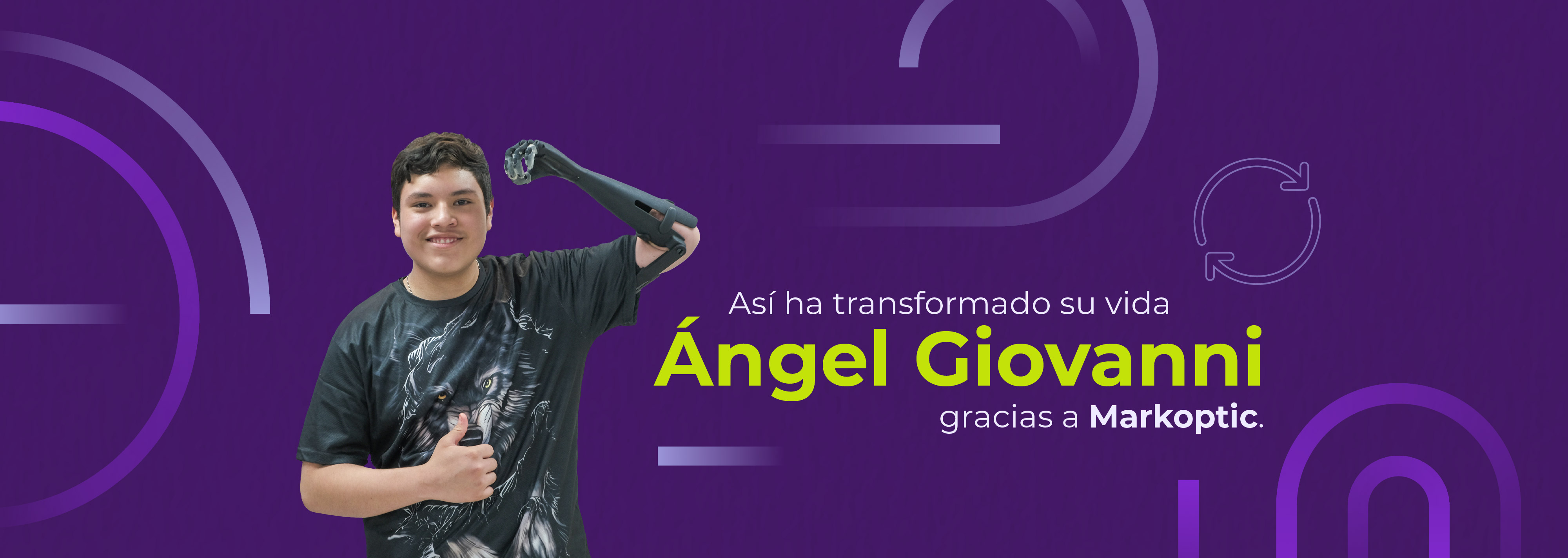 Así ha transformado su vida Ángel Giovanni gracias a Markoptic